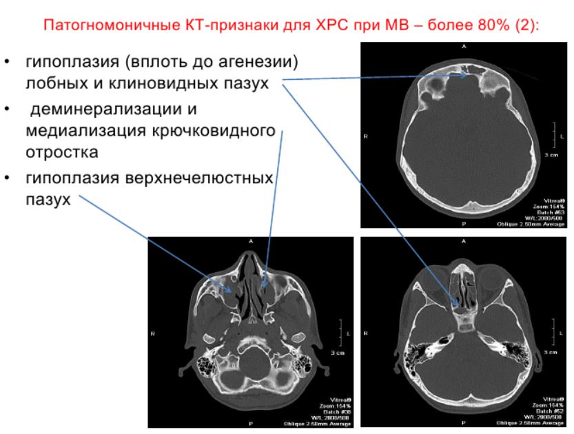 pari-sinus-6