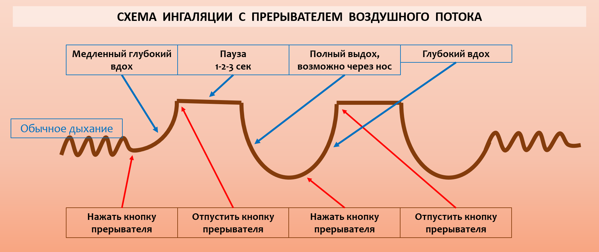 схема ингаляции с прерывателем воздушного потока схема ингаляции с прерывателем воздушного потока